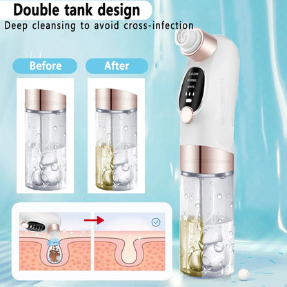 Blackhead Remover Pore Vacuum Face Cleaner Electric Pimple Acne Black Head Removal USB Rechargeable Water Cycle Black Dot Remove