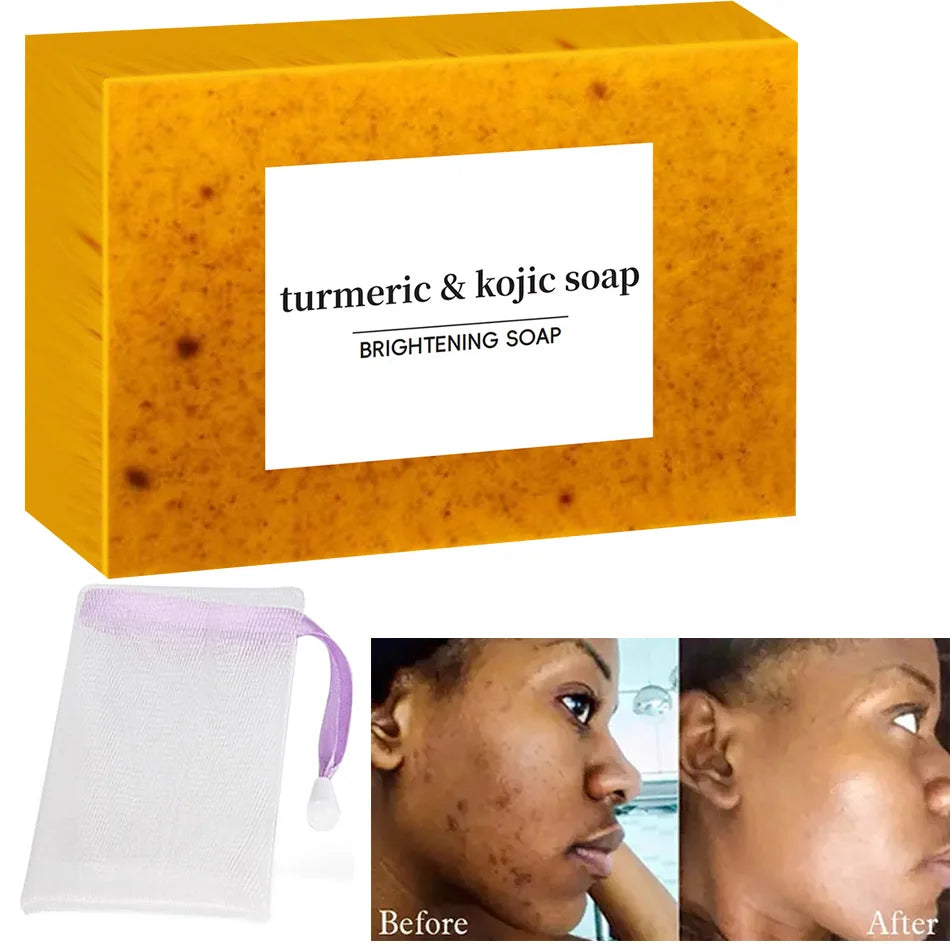 Turmeric Kojic Acid Glow Soap Dark Spot Acne Removal Even Skin Tone Mositen Smooth Skin Deep Cleansing Handmade Soap